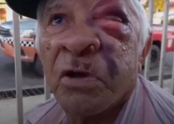 Idoso tem crânio fraturado após tentar separar briga na comunidade Nova Aliança em Santarém, no PA