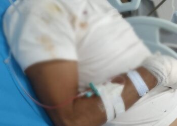 Taxista atende pedido de corrida e tem o braço fraturado após lutar com passageiro que anunciou assalto, em Itaituba