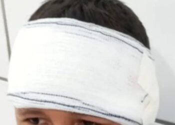 Criança é atingida na cabeça por tiro acidental após brincar com espingarda