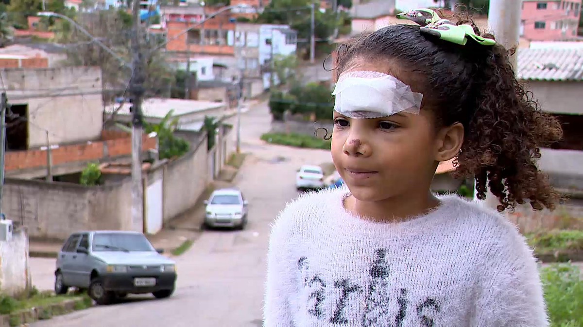 Menina de 7 anos fratura nariz e tem cortes profundos