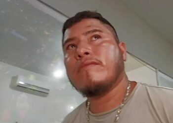 Homem sofre tentativa de homicídio, em Santarém; a vítima foi atingida no rosto