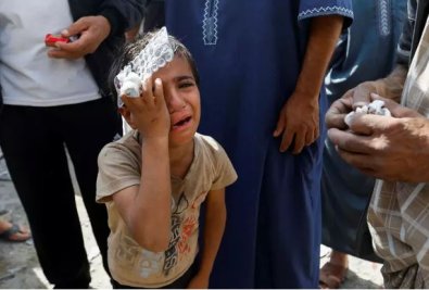 Crianas so submetidas a cirurgias sem sedao em Gaza