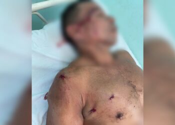 Homem é alvejado a tiros no bairro bela vista