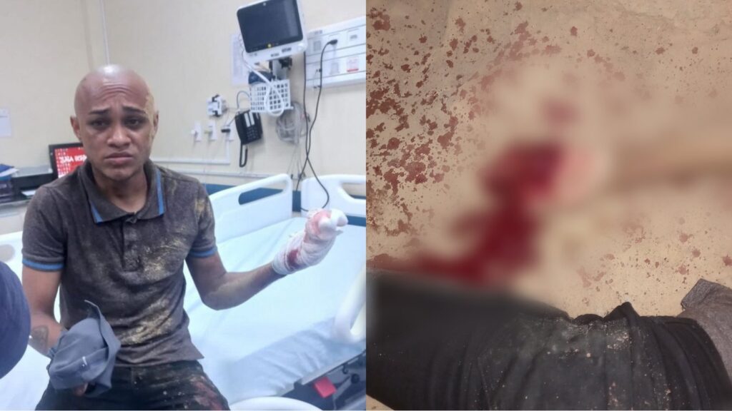 'Neguinho' quase tem a mão decepada no bairro Piracanã em