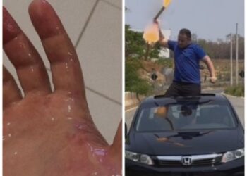 Rojo explode na mo de ‘influencer’ sem noo durante exibicionismo