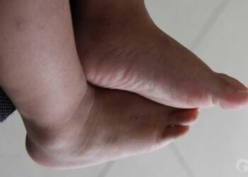 Beb morre aps ser esquecido pelo pai dentro de carro