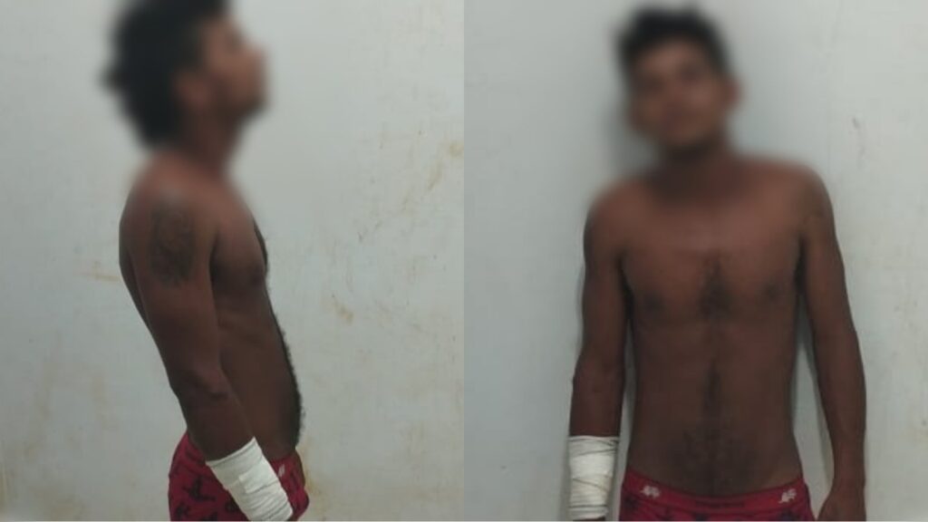 Homem sofre tentativa de homicídio na região garimpeira