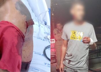 Homem esfaqueado fica com faca cravada na costa em Itaituba, no PA