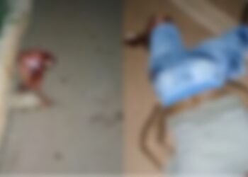 Motociclista tem perna arrancanda em acidente na BR-163