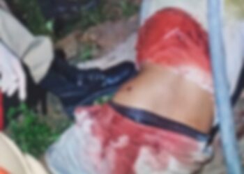 Homem sofre tentativa de homicídio em Itaituba, no PA