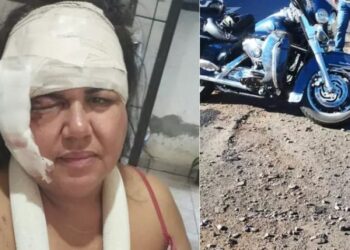 Empresria leva 60 pontos no rosto e quebra brao em acidente