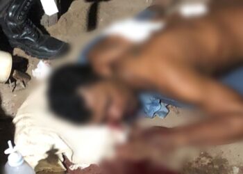 Homem é vítima de disparos de arma de fogo em Itaituba, no Pará