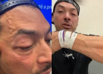 Deputado contra cmeras em farda acusa PM de agredi-lo
