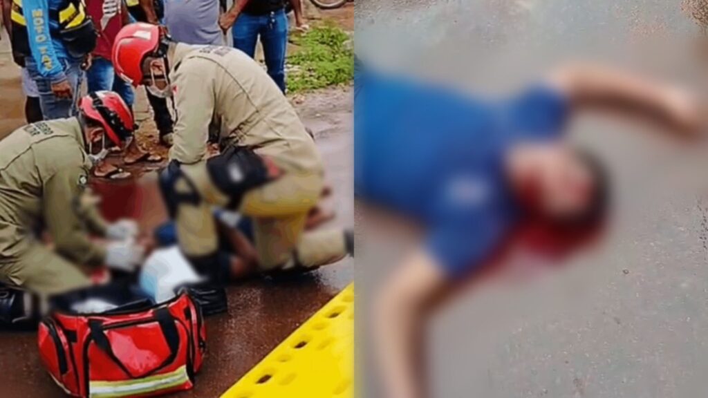 Jovem sofre fratura exposta na cabeça após colisão entre moto