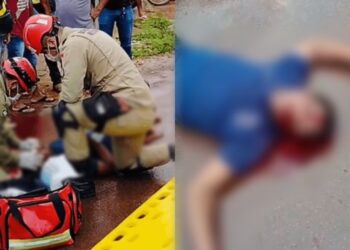 Jovem sofre fratura exposta na cabeça após colisão entre moto e caçamba em Itaituba