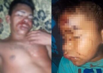 Pai e filho de 4 anos são espancados em comunidade no Lago Grande, em Santarém