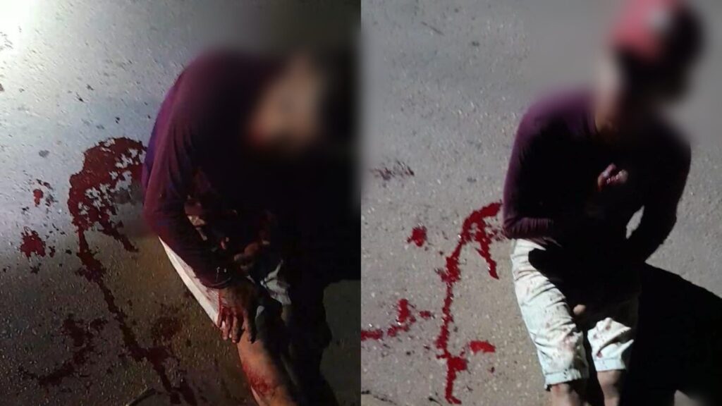 Dois homens são baleados e socorridos durante a madrugada em