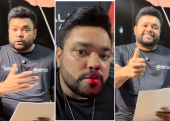 Cantor perdoa agressor por ataque com lata de cerveja: só queremos paz | FOLHAMAX