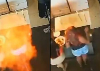 Cabelo de mulher pega fogo aps acidente em restaurante | FOLHAMAX