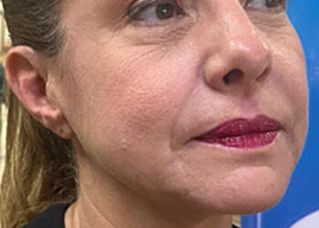 Cerqueira nega perseguir prefeita | RDNEWS