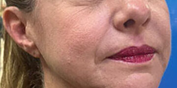 Cerqueira nega perseguir prefeita | RDNEWS