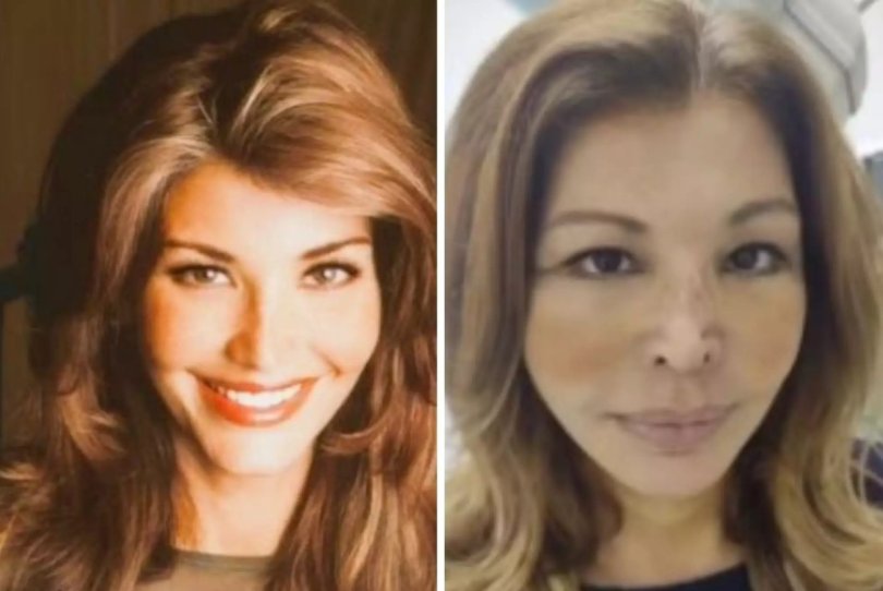 Musa dos anos 80, Roberta Close se rende a procedimentos estticos | FOLHAMAX