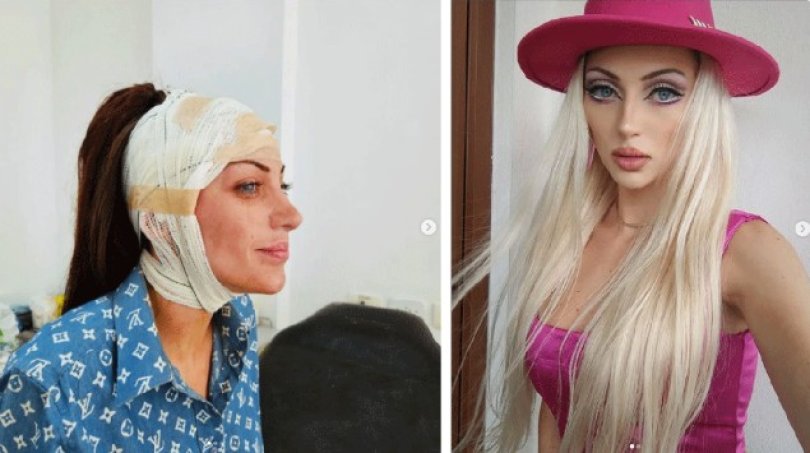 Influencer chamada de ‘Barbie humana’ encontrada morta em casa | FOLHAMAX