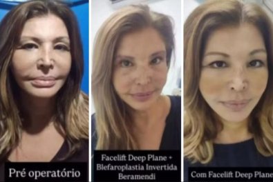 Roberta Close -CIRURGIA.jpg