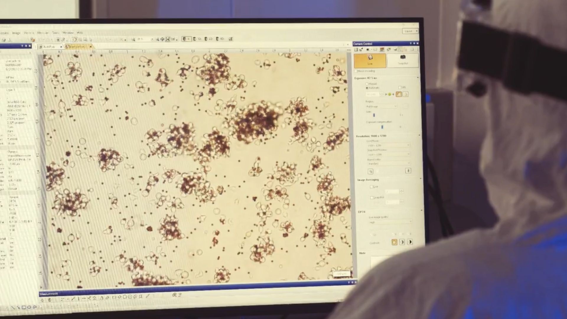 Car-T: terapia contra câncer pode ter pedido de registro na Anvisa em 2026, diz pesquisador