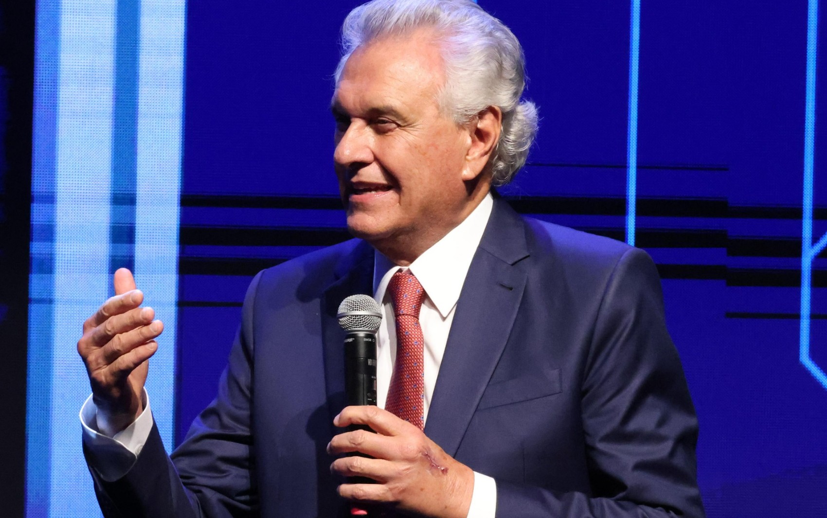 Ablação cardíaca: Entenda o tratamento de arritmia de Caiado