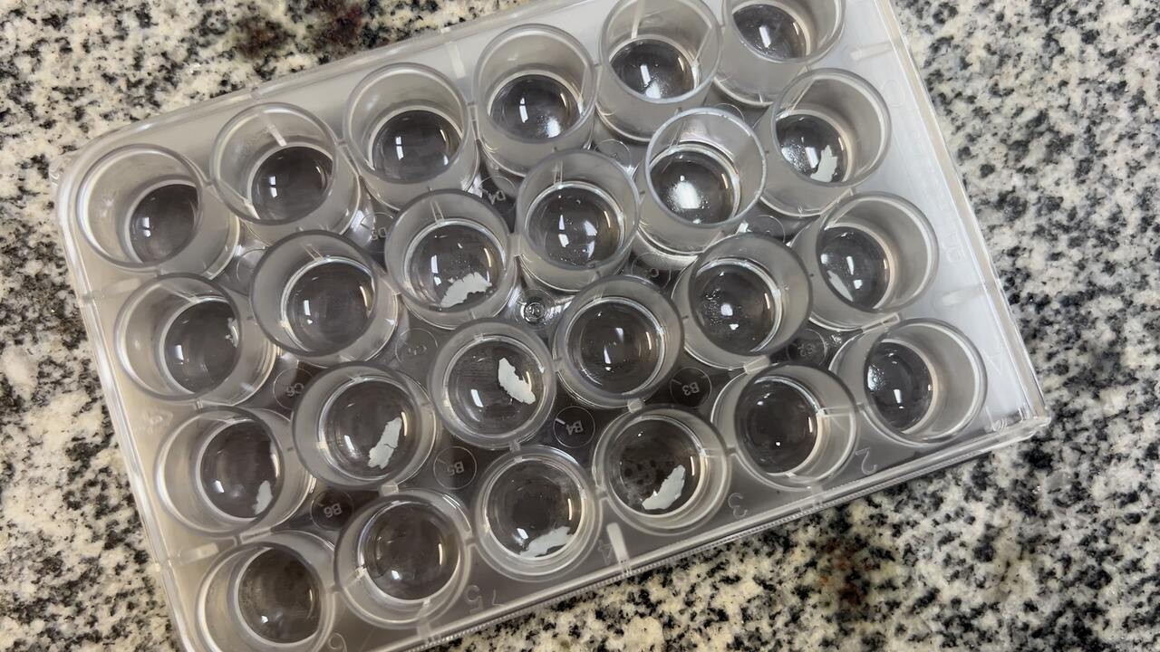 Como Covid e Oropouche podem antecipar risco de doenças cerebrais