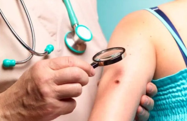 Unimed Cuiabá: melhor forma de evitar o câncer de pele é se proteger do sol | RDNEWS