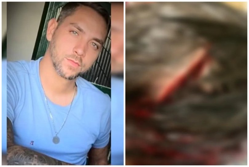 Homem ataca e rasga cabea de mulher durante festa de 1 ano do filho | FOLHAMAX