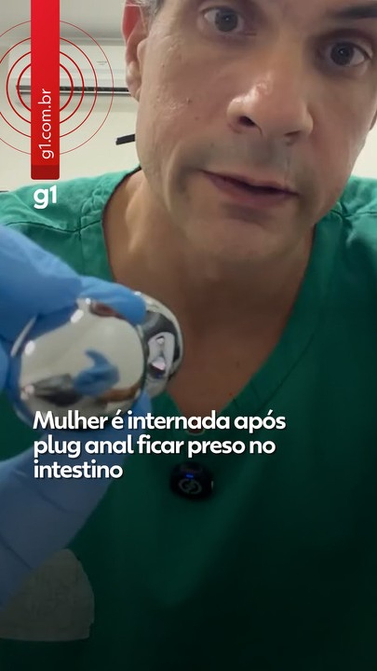 Mulher é internada após plug anal ficar preso no intestino; médicos alertam para riscos no uso do acessório
