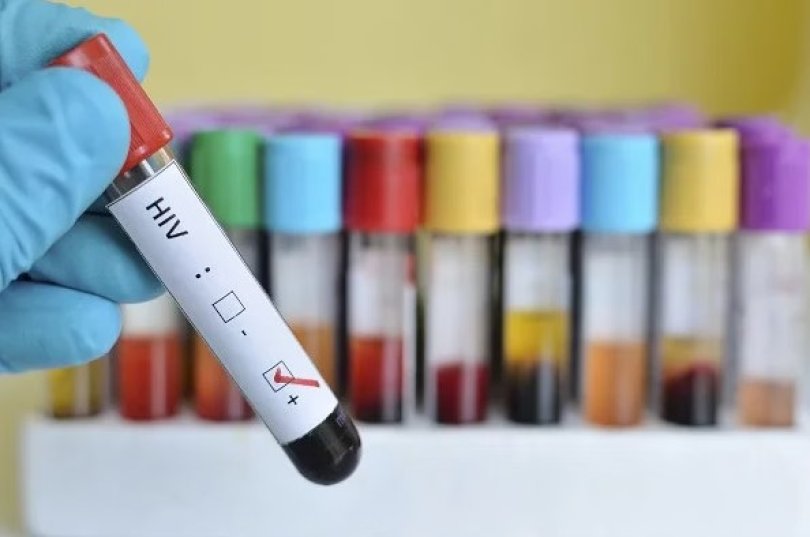 Dentista denunciado por transmitir HIV de propsito para mulheres | FOLHAMAX