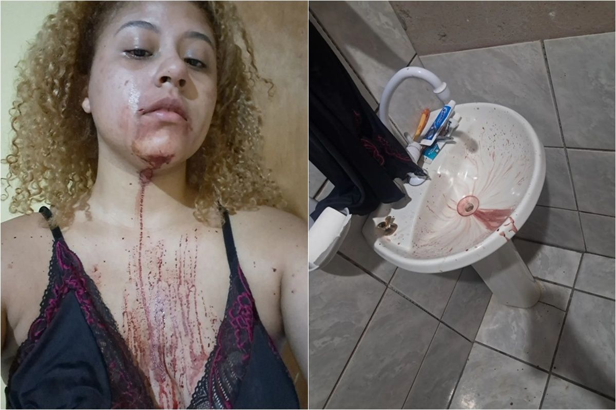 Estudante denuncia PMs por agressão em Cuiabá: Quero justiça
